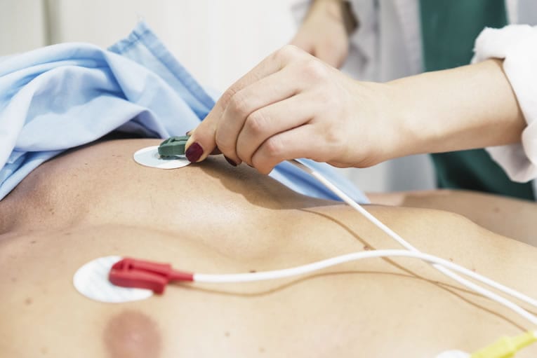 ELETROCARDIOGRAMA